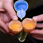 Menjaga Kenyamanan Prostat untuk Mendukung Aktivitas Sehari-hari